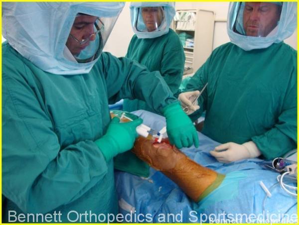 prp-knee-replacement-dr-bennett